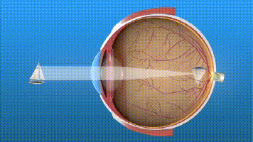眼保健操真的能保护视力，预防近视吗？