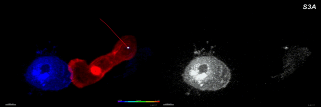 《细胞》子刊：啊，可爱而勇猛的抗癌能手T细胞！科学家拍摄到 T 细胞追杀癌细胞的矫健身姿及全过程（多动图） | 科学大发