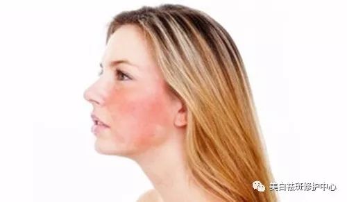 涂涂护肤老师：激素脸夏季如何科学的使用空调呢？