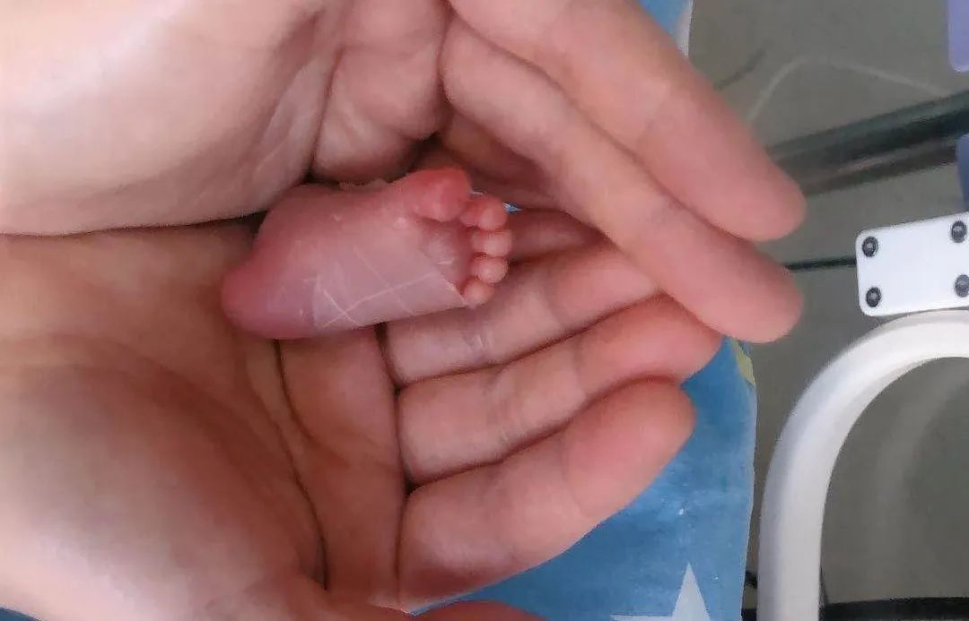 提前3个多月出生！杭州二胎妈妈突然产下男婴，体重只有1200g，历经71天终于回家