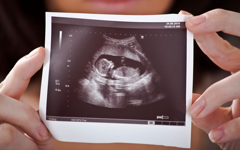 怀孕生孩子那些事 之 为什么用B超对胎儿估重估不准？