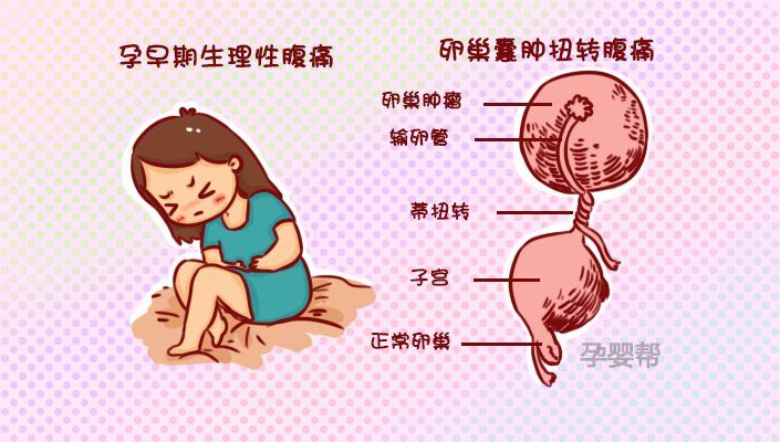 6种孕期腹痛，正常或异常要分清，千万不要大意！
